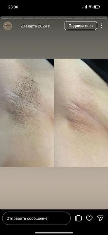 Кызматтар: Шугаринг, Мом менен эпиляция, Үйгө баруу кызматы менен — 5
