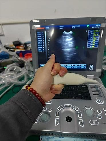 Ингаляторы, небулайзеры: Портативный ультразвуковой аппарат SUNBRIGHT (ноутбучный форм‑фактор) — 7