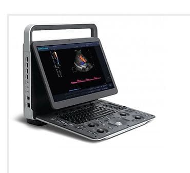 Инвалидные коляски: УЗИ SonoScape. Мобильный. 3 датчиками. Почти новый. Есть принтер и — 2