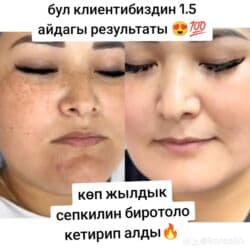 Так,сепкил,куперез и бырышка 👍🔥Самый эффективный сыворотка крем 💯