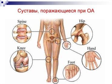 эко спрей от вшей как пользоваться: Бишофит от чего помогает. опорно-двигательного аппарата — 6