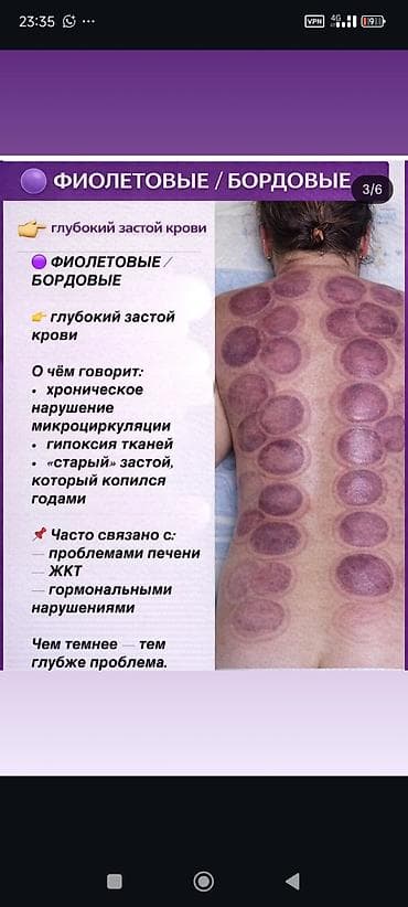 Массаж: Массаж | Сутулость, нарушение осанки — 3