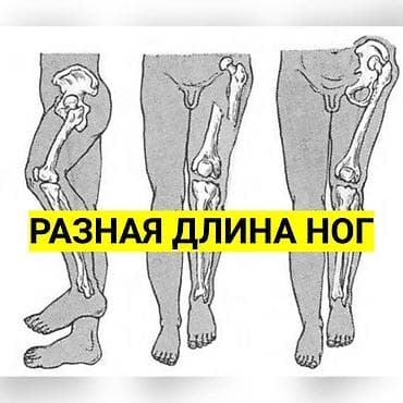 стелька: Стельки для роста (7 видов) Адрес: Лермонтова — 6