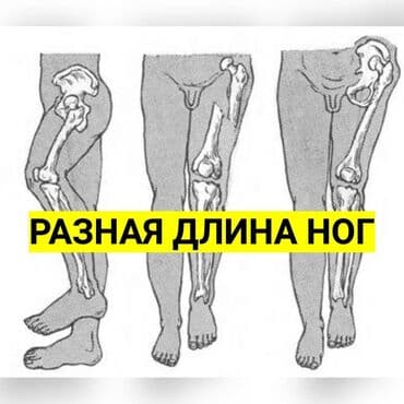 белорусская обувь для проблемных ног бишкек: Стельки для роста (7 видов) Адрес: Лермонтова — 6