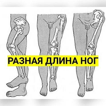 стелька: Стельки для роста (7 видов) Адрес: Лермонтова — 2