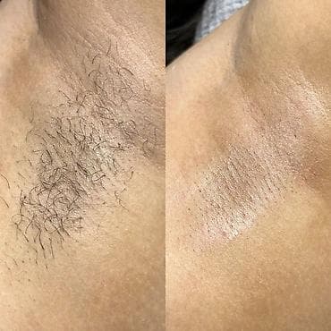 ищу работу в салоне: Курсы | Мастера депиляции Выдается сертификат, Предоставление расходного материала, Предоставление моделей — 4