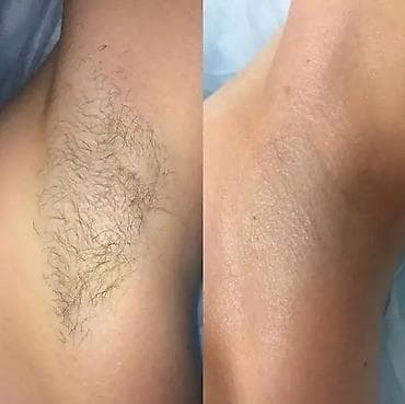 убрать живот: ТОЛЬКО ДЛЯ ЖЕНЩИН Шугаринг и восковая депиляция Услуга at lalafo.kg — 7 убрать живот: ТОЛЬКО ДЛЯ ЖЕНЩИН Шугаринг и восковая депиляция Услуга — 7