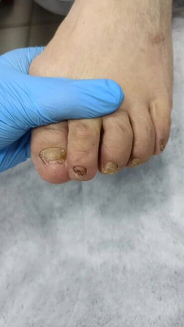 Түздөө, Тырмак өстүрүү, Тырмактарды кошумча өстүрүү, Маникюр, Педикюр, Подолог кызматтары, Консультация, Бир жолку сарпталуучу материалдар lalafo.kg да Түздөө, Тырмак өстүрүү, Тырмактарды кошумча өстүрүү, Маникюр, Педикюр, Подолог кызматтары, Консультация, Бир жолку сарпталуучу материалдар