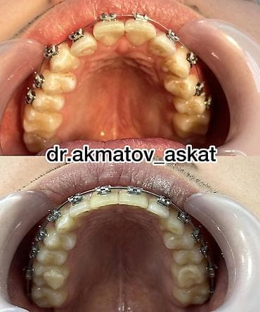 Haima: Дарыгерлер | Стоматолог | Консультация lalafo.kg да — 2 Haima: Дарыгерлер | Стоматолог | Консультация — 2