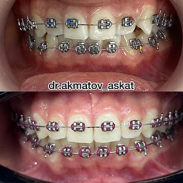 Haima: Дарыгерлер | Стоматолог | Консультация lalafo.kg да — 1 Haima: Дарыгерлер | Стоматолог | Консультация — 1