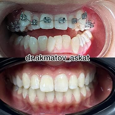 Haima: Дарыгерлер | Стоматолог | Консультация lalafo.kg да — 7 Haima: Дарыгерлер | Стоматолог | Консультация — 7