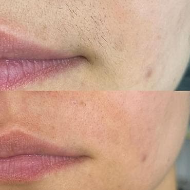 убрать живот: ТОЛЬКО ДЛЯ ЖЕНЩИН Шугаринг и восковая депиляция Услуга at lalafo.kg — 6 убрать живот: ТОЛЬКО ДЛЯ ЖЕНЩИН Шугаринг и восковая депиляция Услуга — 6