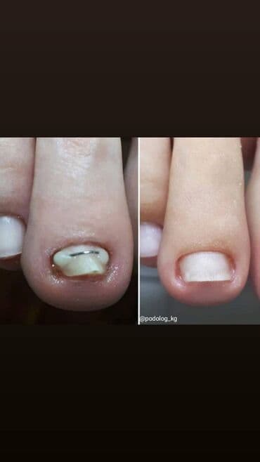 Түздөө, Тырмак өстүрүү, Тырмактарды кошумча өстүрүү, Маникюр, Педикюр, Подолог кызматтары, Консультация lalafo.kg да Түздөө, Тырмак өстүрүү, Тырмактарды кошумча өстүрүү, Маникюр, Педикюр, Подолог кызматтары, Консультация