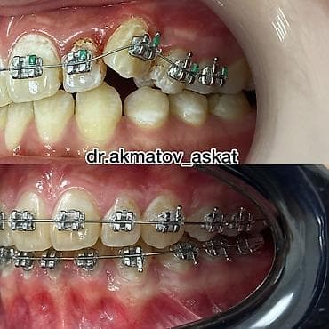 Haima: Дарыгерлер | Стоматолог | Консультация lalafo.kg да — 5 Haima: Дарыгерлер | Стоматолог | Консультация — 5