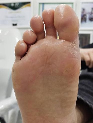 Перманенттик макияж: Ичине кирип өскөн тырмактарды оңдоо, Педикюр, Подолог кызматтары, Консультация, Бир жолку сарпталуучу материалдар lalafo.kg да — 8 Перманенттик макияж: Ичине кирип өскөн тырмактарды оңдоо, Педикюр, Подолог кызматтары, Консультация, Бир жолку сарпталуучу материалдар — 8