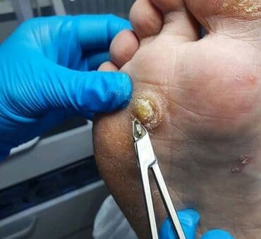 Түздөө, Тырмак өстүрүү, Тырмактарды кошумча өстүрүү, Маникюр, Педикюр, Подолог кызматтары, Консультация lalafo.kg да Түздөө, Тырмак өстүрүү, Тырмактарды кошумча өстүрүү, Маникюр, Педикюр, Подолог кызматтары, Консультация