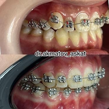 Haima: Дарыгерлер | Стоматолог | Консультация lalafo.kg да — 6 Haima: Дарыгерлер | Стоматолог | Консультация — 6