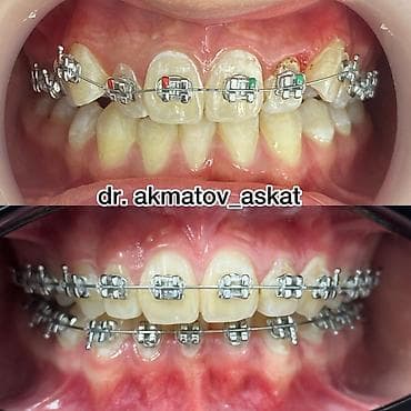 Haima: Дарыгерлер | Стоматолог | Консультация lalafo.kg да — 4 Haima: Дарыгерлер | Стоматолог | Консультация — 4