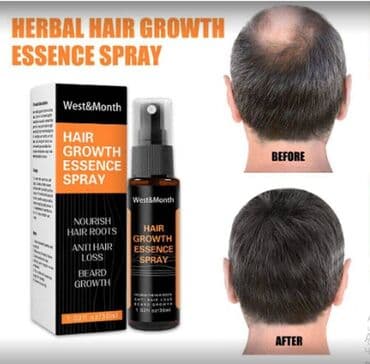 США Миноксидил Оригинал прямые поставки листаем фото читаем обьявление at lalafo.kg США Миноксидил Оригинал прямые поставки листаем фото читаем обьявление