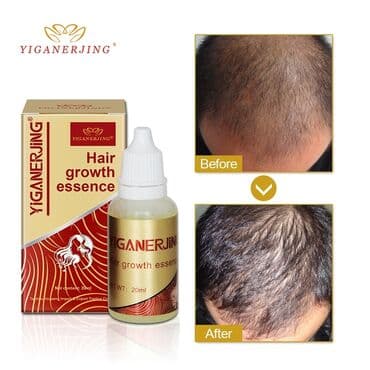 Средство против выпадения и для восстановления волос для мужчин и at lalafo.kg Средство против выпадения и для восстановления волос для мужчин и