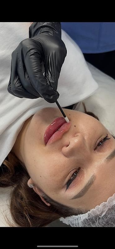 Косметология, Увеличение губ, Ботокс, Биоревитализация, Сертифицированный косметолог, С выездом на дом, Консультация at lalafo.kg Косметология, Увеличение губ, Ботокс, Биоревитализация, Сертифицированный косметолог, С выездом на дом, Консультация