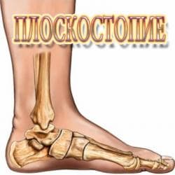 Стельки ортопедические(специализированные) от плоскостопия Для at lalafo.kg Стельки ортопедические(специализированные) от плоскостопия Для