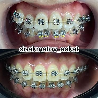 Haima: Дарыгерлер | Стоматолог | Консультация lalafo.kg да — 3 Haima: Дарыгерлер | Стоматолог | Консультация — 3