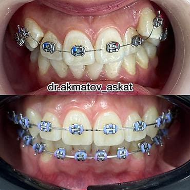 Haima: Дарыгерлер | Стоматолог | Консультация lalafo.kg да — 8 Haima: Дарыгерлер | Стоматолог | Консультация — 8