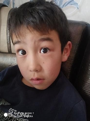 Redmi, Redmi 7 at lalafo.kg Redmi, Redmi 7