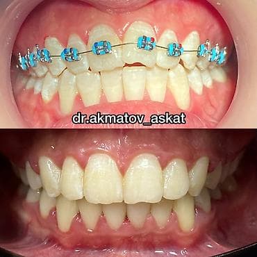 Haima: Дарыгерлер | Стоматолог | Консультация lalafo.kg да — 9 Haima: Дарыгерлер | Стоматолог | Консультация — 9