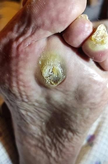 Перманенттик макияж: Ичине кирип өскөн тырмактарды оңдоо, Педикюр, Подолог кызматтары, Консультация, Бир жолку сарпталуучу материалдар lalafo.kg да — 1 Перманенттик макияж: Ичине кирип өскөн тырмактарды оңдоо, Педикюр, Подолог кызматтары, Консультация, Бир жолку сарпталуучу материалдар — 1