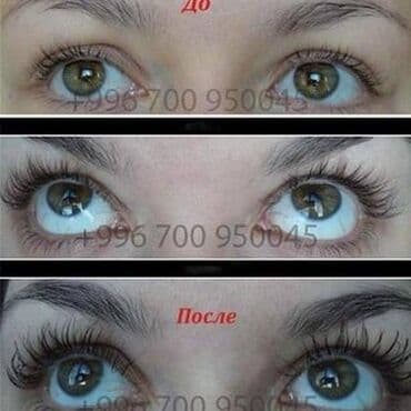 Средство для роста ресниц. 100% гарантия. Карепрост. Careprost at lalafo.kg Средство для роста ресниц. 100% гарантия. Карепрост. Careprost