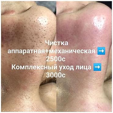 Косметология, Маски, Массаж лица, Отбеливание пигментных пятен, Консультация, Гипоаллергенные материалы, Сертифицированный косметолог at lalafo.kg Косметология, Маски, Массаж лица, Отбеливание пигментных пятен, Консультация, Гипоаллергенные материалы, Сертифицированный косметолог