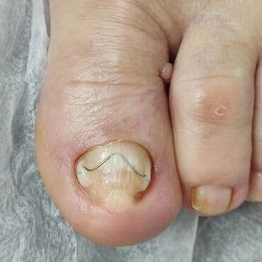 Тырмак өстүрүү, Тырмактарды кошумча өстүрүү, Шеллак, Маникюр, Педикюр, Подолог кызматтары, Консультация, Бир жолку сарпталуучу материалдар lalafo.kg да Тырмак өстүрүү, Тырмактарды кошумча өстүрүү, Шеллак, Маникюр, Педикюр, Подолог кызматтары, Консультация, Бир жолку сарпталуучу материалдар