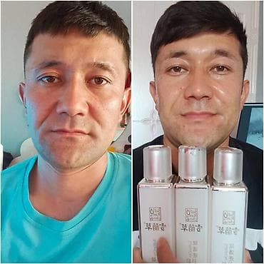 Снежная Орхидея омолаживающий спрей В спрее работают 4 пептида — они at lalafo.kg Снежная Орхидея омолаживающий спрей В спрее работают 4 пептида — они