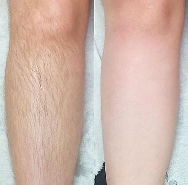 убрать живот: ТОЛЬКО ДЛЯ ЖЕНЩИН Шугаринг и восковая депиляция Услуга at lalafo.kg — 2 убрать живот: ТОЛЬКО ДЛЯ ЖЕНЩИН Шугаринг и восковая депиляция Услуга — 2