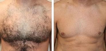 Мужская депиляция обладает рядом неоспоримых преимуществ: • Позволяет at lalafo.kg — 1 Мужская депиляция обладает рядом неоспоримых преимуществ: • Позволяет — 1