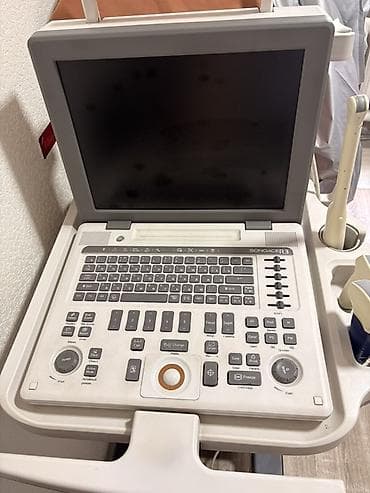 УЗИ-аппарат Samsung Medison SonoAce R3 с тележкой VET R3 Cart at lalafo.kg УЗИ-аппарат Samsung Medison SonoAce R3 с тележкой VET R3 Cart