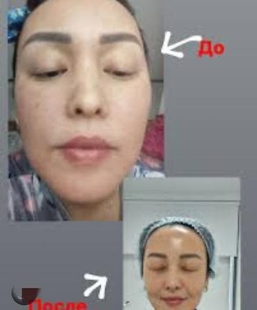 убрать живот: Капельница Золушка 💖 укрепление здоровьямолодости кожи лица отёк at lalafo.kg — 4 убрать живот: Капельница Золушка 💖 укрепление здоровьямолодости кожи лица отёк — 4
